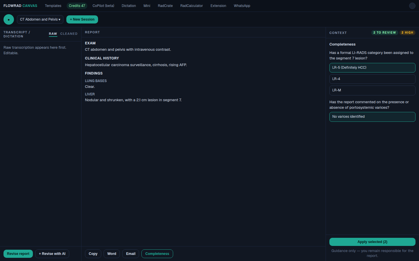 Agent Swarm check in FlowRad Canvas